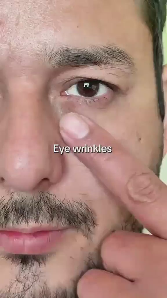 Dr Melaxin - Eyephalt Eyecream-كريم د. ميلاكسين آي فالت للعين